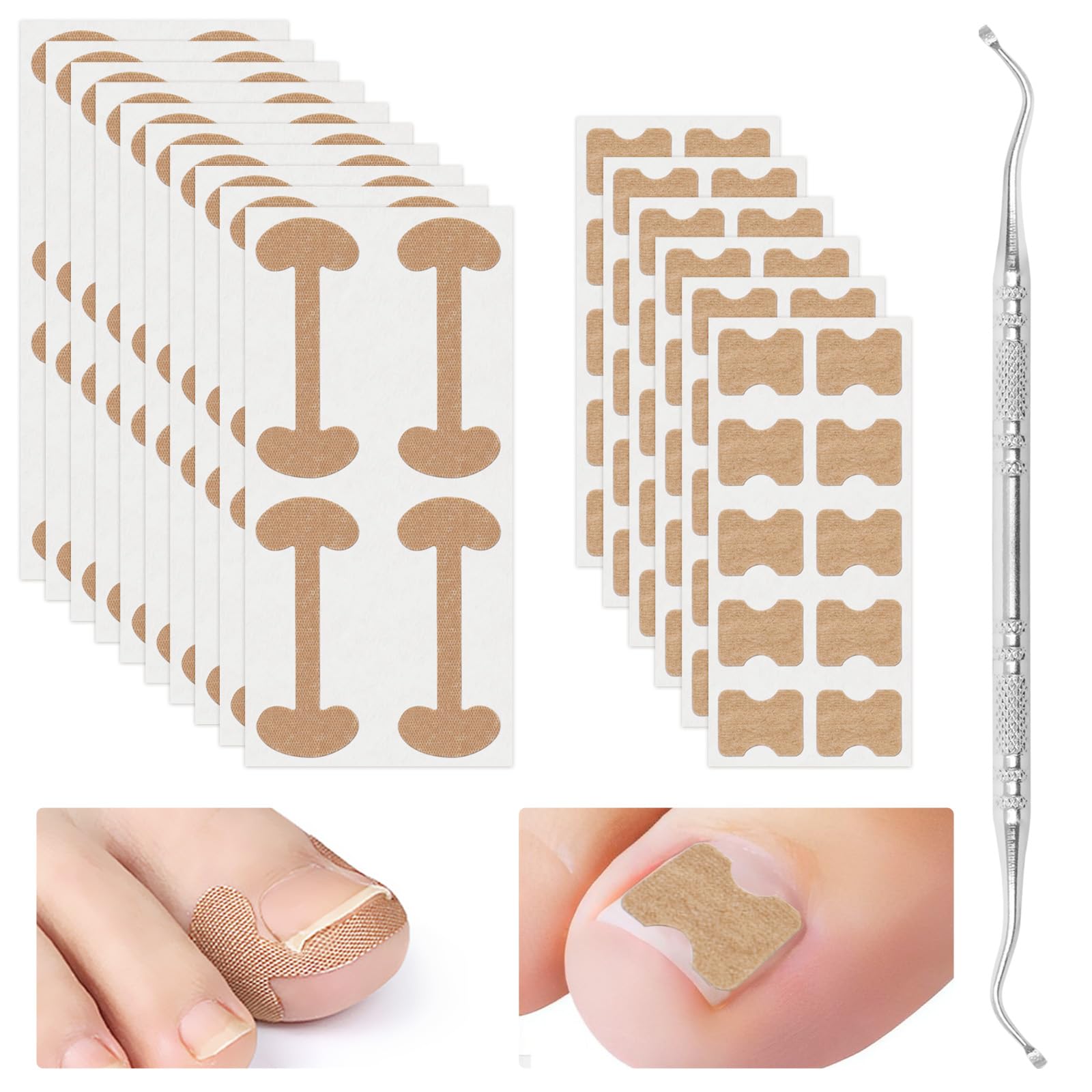 Xinzan 2 Types Ingrown Toenail Treatment Patch with Ingrown Toenail Tool, Professional Ingrown Toenail Corrector Tools for Toenail Care Protect Toe Nail