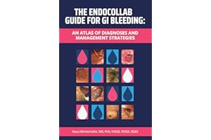 The EndoCollab Guide for GI Bleeding: An Atlas of Diagnoses and Management Strategies