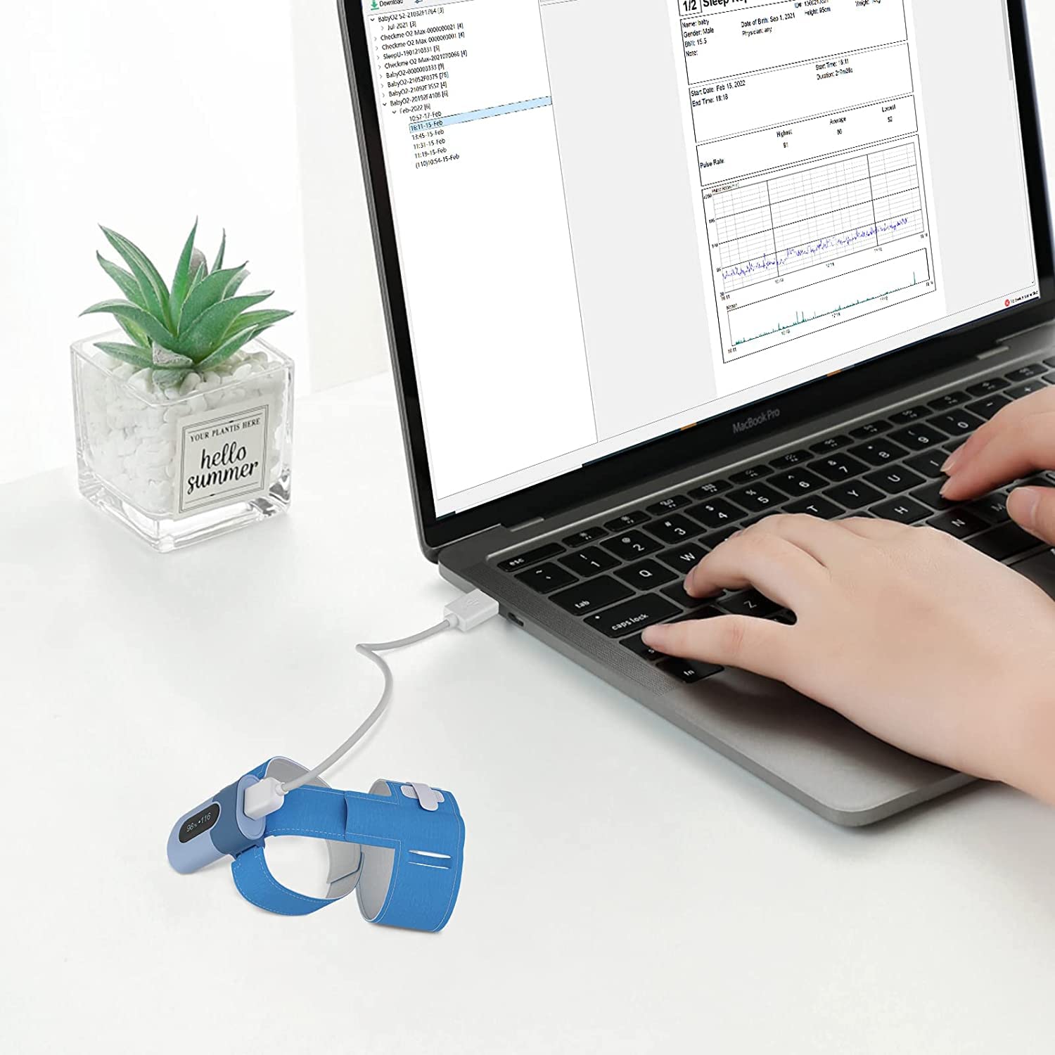Original D-Type USB Charge Data Cable for Checkme O2 Max, SleepU, VisualOxy, Oxiband Ring Pulse Oximeter, BabyO2, BabyO2 S2