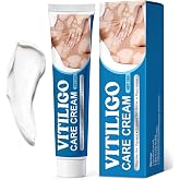 Vitiligo Treatment Cream for Men &amp; Women, Vitiligo Cream, 20g | Effective Vitiligo Cream for Pigmentation &amp; White Spots, Natural Formula, Gentle on All Skin