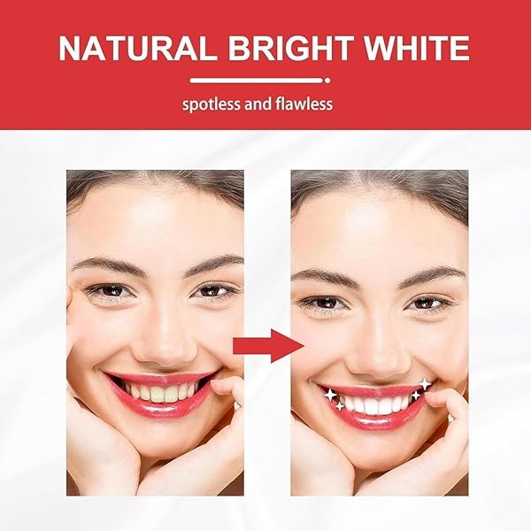 2PC PROBIOTIC SP-10 TOOTHPASTE, SP-10 ULTRA WHITENING TOOTHPASTE, SP-10 PROBIOTIC STAIN REMOVAL TOOTHPASTE, FRESH BREATH,DEEP CLEANING CARE TOOTHPASTE