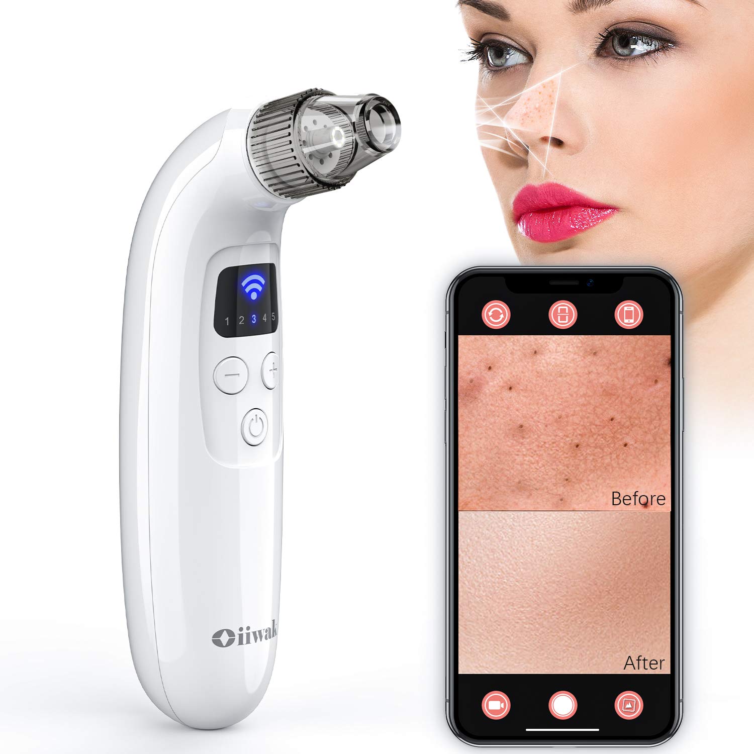 Oiiwak WiFi Blackhead Remover with Camera Pore Vacuum Acne Comedo Extractor Pimple Popper Sucker Beauty Device