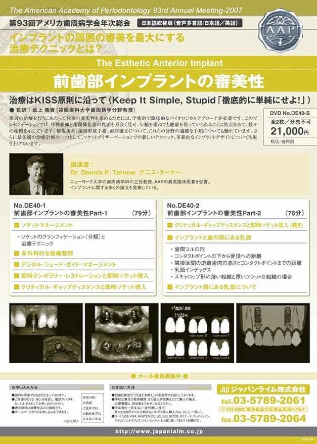 Amazon Co Jp De40 前歯部インプラントの審美性 Dvd ブルーレイ ジャパンライム株式会社