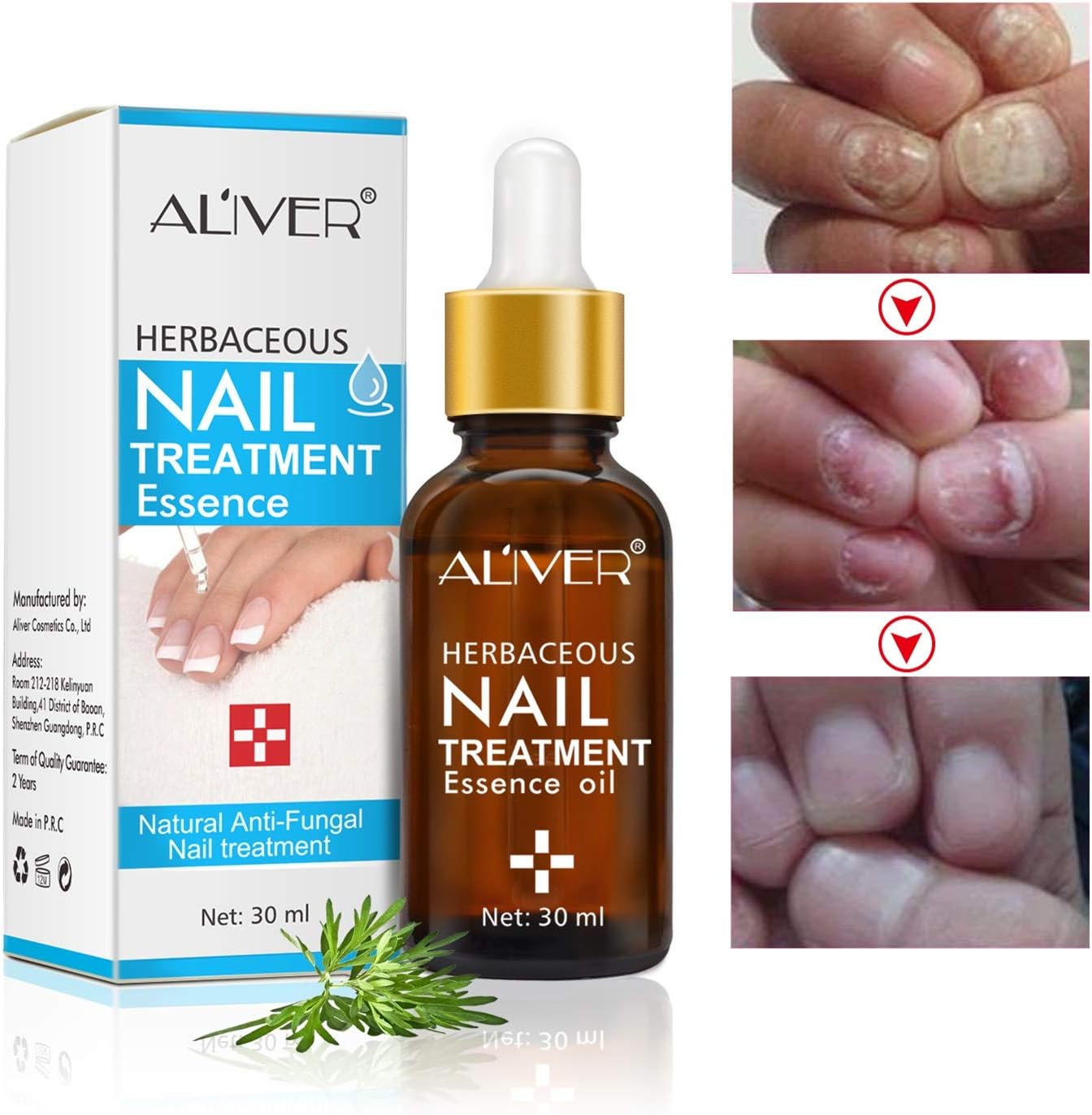 Nail Fungus Treatment,Fungus Stop,Nail Antifungal Treatment,Nail Fungus Treatment Essence Oil,Anti Fungus Nail Treatment,Toenails and Fingernails Solution,Restores Toenail Fungus