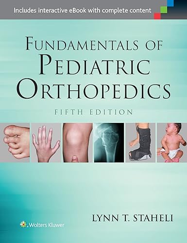Download Fundamentals of Pediatric Orthopedics PDF