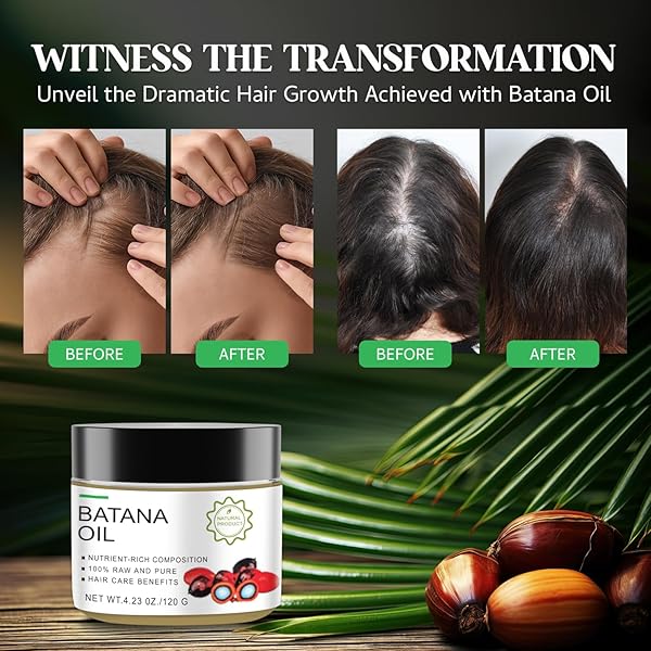 SUPREH ORGANIC BATANA OIL FOR HAIR GROWTH: 100% NATURAL UNREFINED BATANA OIL FROM HONDURAS AS HAIR MASK BY DR. SEBI – HAIR REPAIR TREATMENT FOR DAMAGED HAIR, REDUCES HAIR LOSS, BROWN