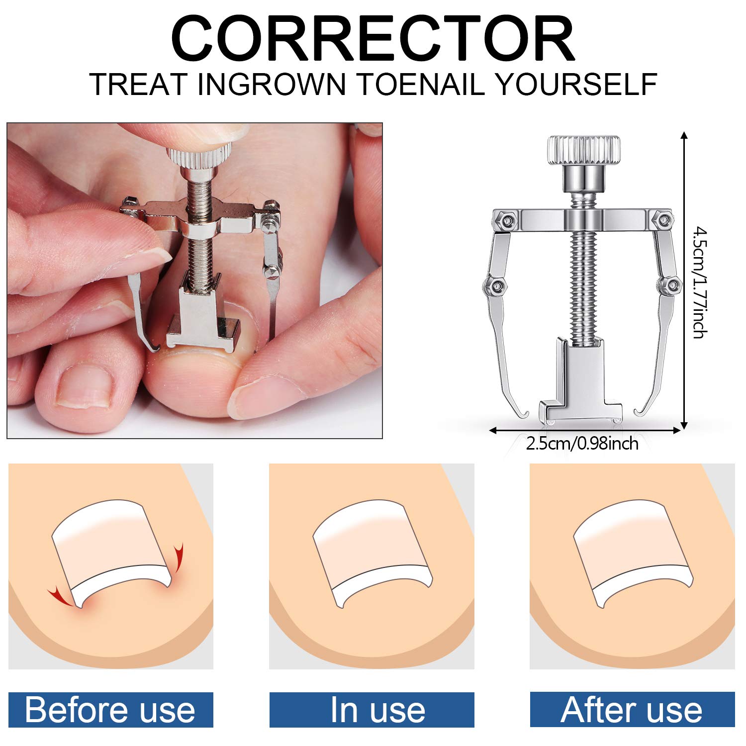 15 Pieces Ingrown Toenail Tools Stainless Steel Foot Nail Tools, Include Toenail File and Lifter, Nail Clipper, Cuticle Cutters, Cuticle Pusher and Manicure Pedicure Tools for Ingrown and Thick Nail: Beauty