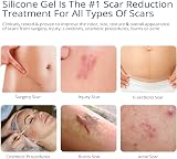 MURASAKI BEAUTY Silicone Scar Gel 30g Scar Treatment for Old & New Scars view 2