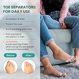 Welnove 8 Pack Toe Separators Aloe Vera Medical Gel Foot Spacers view 5