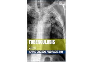 TUBERCULOSIS: 2020