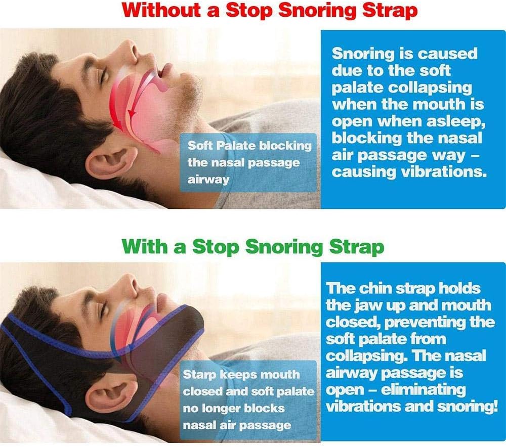 Strap to Stop Snoring, Anti-snoring Unisex Jaw Belt, Get Restful Sleep and Wake Up Energized. Adjustable Chin Strap.: Kitchen & Dining