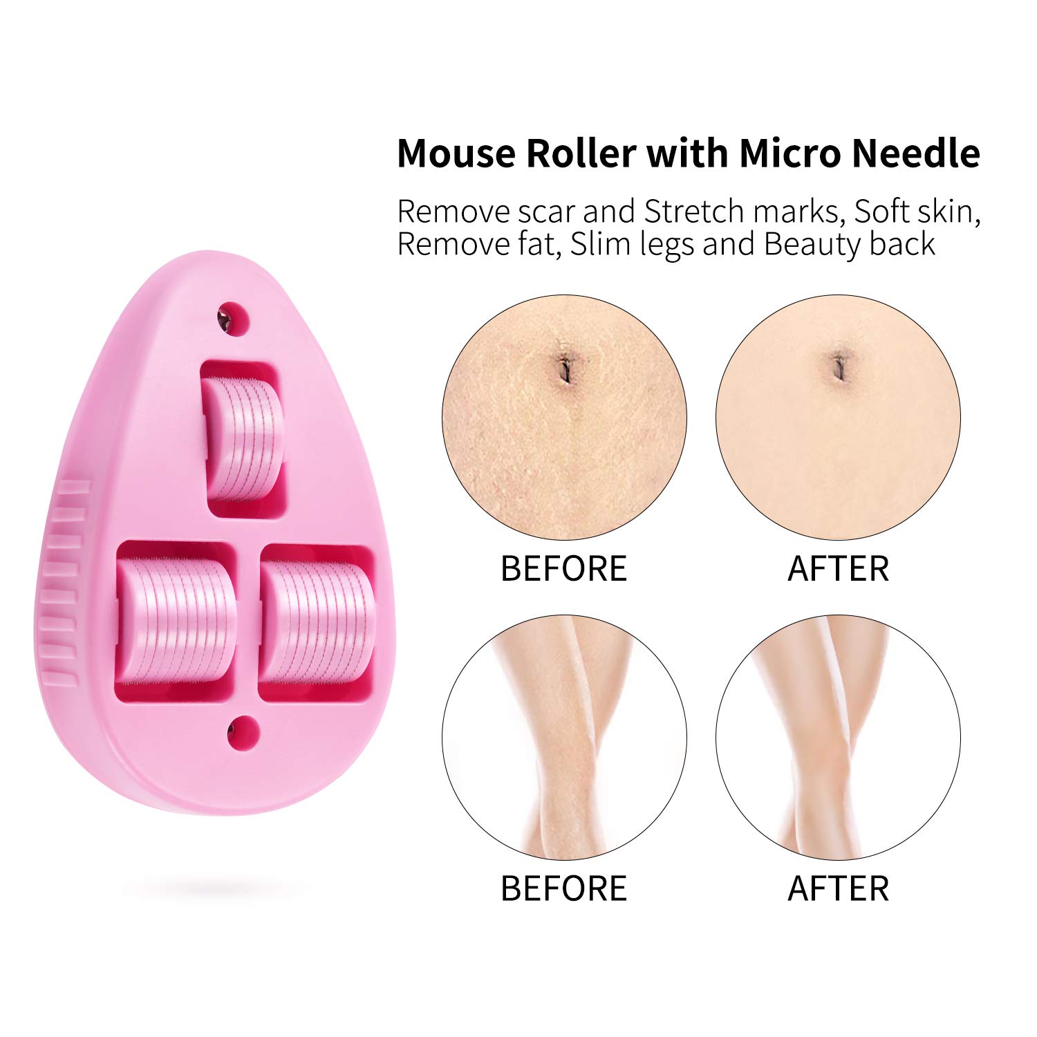 Derma Roller 0.3mm for Body Mouse Roller Microneedling, Beautlinks 3 Microneedle Rollers Combined Mouse Roller for Body, Includes Storage Case (Pink)
