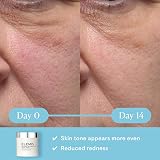 Elemis Dynamic Resurfacing Facial Pads 60 Pack Gentle Exfoliating Rounds view 3