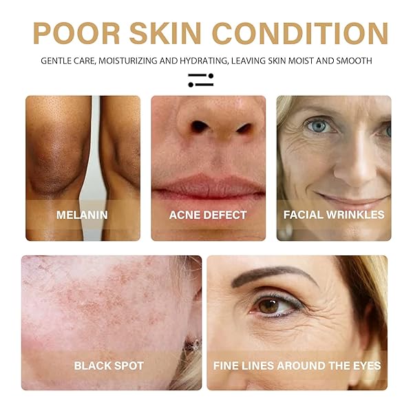 2022 NEW TURMERIC DARK SPOT CORRECTOR SERUM, TURMERIC REPAIR FACE SERUM, BRIGHT SKIN DARK SPOT SKIN CARE MOISTURIZING REPAIR SERUM. 30ML