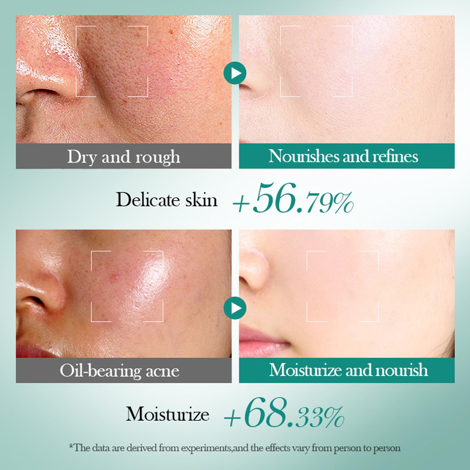 Skincare Set For Teenage Girls, 6-In-1 Skincare Gift Set With Facial Cleanser, Face Serum, Face Cream, Eye Cream, Toner & Lotion, Basic Skincare Box, Gift Sets for Women Mothers Day Gifts