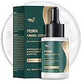 YAFUSIPE Instant Face Lift Serum with 99% Salmon DNA PDRN Peptide Ampoule - Hydrating Anti-Aging Serum for Women, Peptides Serum for Face Reduces Wrinkles & Fine Lines, Glass Skin Glow 1.01 fl.oz