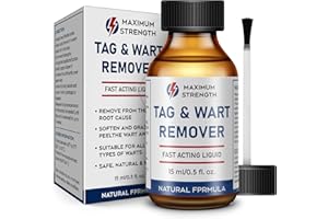 SKAYAH 15ML Skin Tag Removal Kit, Wart Remover Freeze Off, Strongest Plantar wart Remover for Feet, Invisible Wart Remover for Corn, H Warts, Common Wart-5322