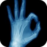 Best X-Ray FREE