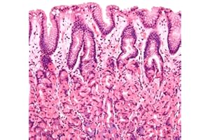 WARP UNITED Set of 100 Microscope Prepared Typical Histology Slides for Medical Study Education Teaching