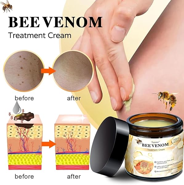NCHAMPIONBA BEE VENOM CREAM, PROFESSIONAL BEE VENOM REPAIR CREAM, NATURAL SKIN MOISTURIZER, NEW BEE VENOM SKIN CREAM FOR ALL SKIN TYPES (2PCS)