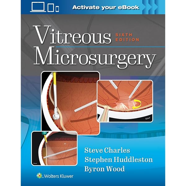 Vitreous Microsurgery: 9781608315031: Medicine & Health Science