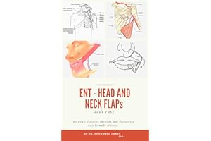 ENT - HEAD and NECK FLAPs MADE EASY: otolaryngology , head and neck reconstruction , ent board preparation , local regional a
