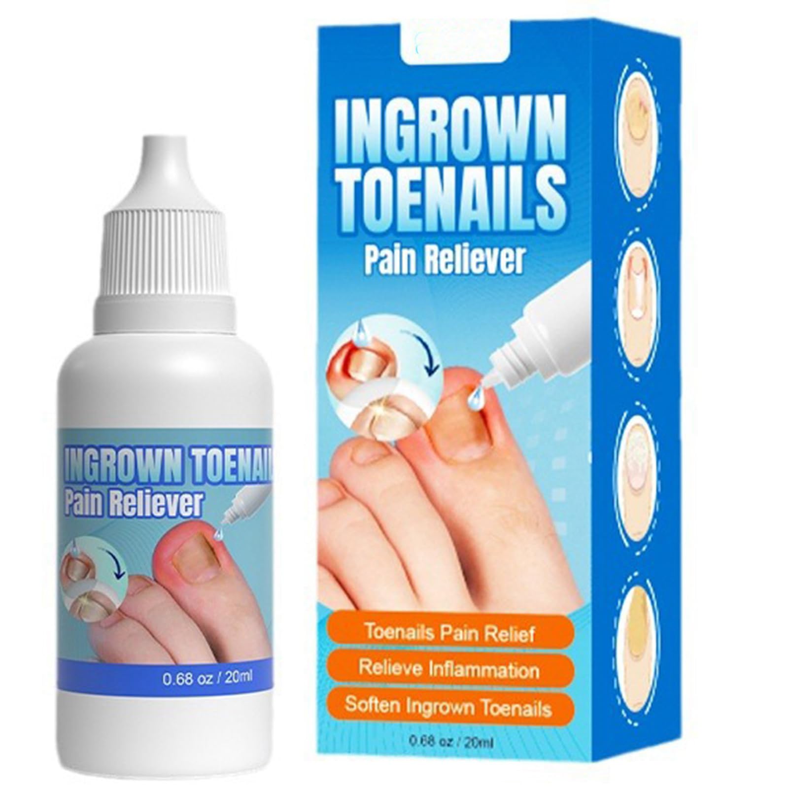 Ingrown Toenail Treatmant Extra Strong - Ingrown Toenail Drop- Cuticle Care Oil for Ingrown Toenails - Trimming Toenail Softening Drop Ingrown Toenail Correction,20ml