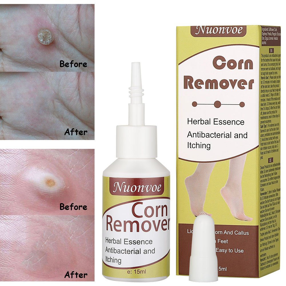 Corn Remover, Callus Remover, Callus Eliminator, Callus And Corn