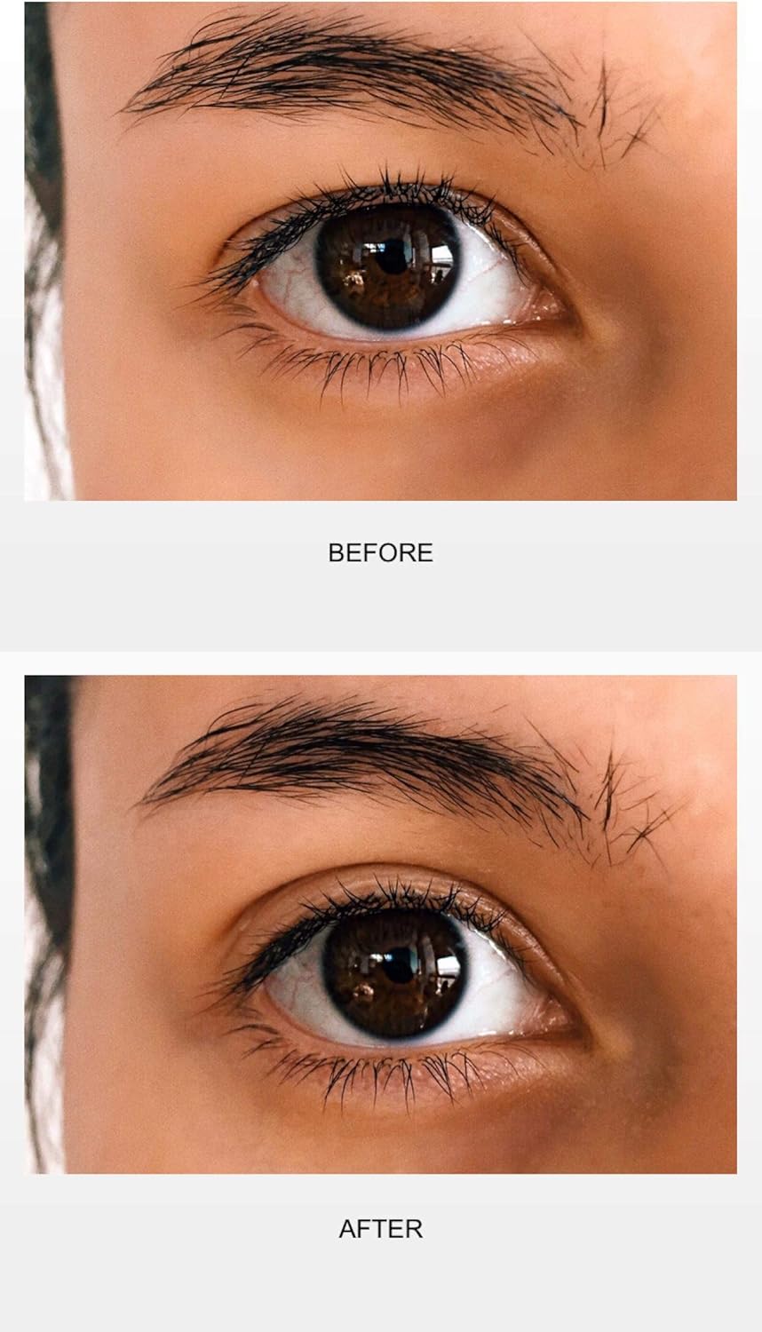 APRICOT Eyelid Tapes against drooping eyelids (96 tapes/sizes S+M