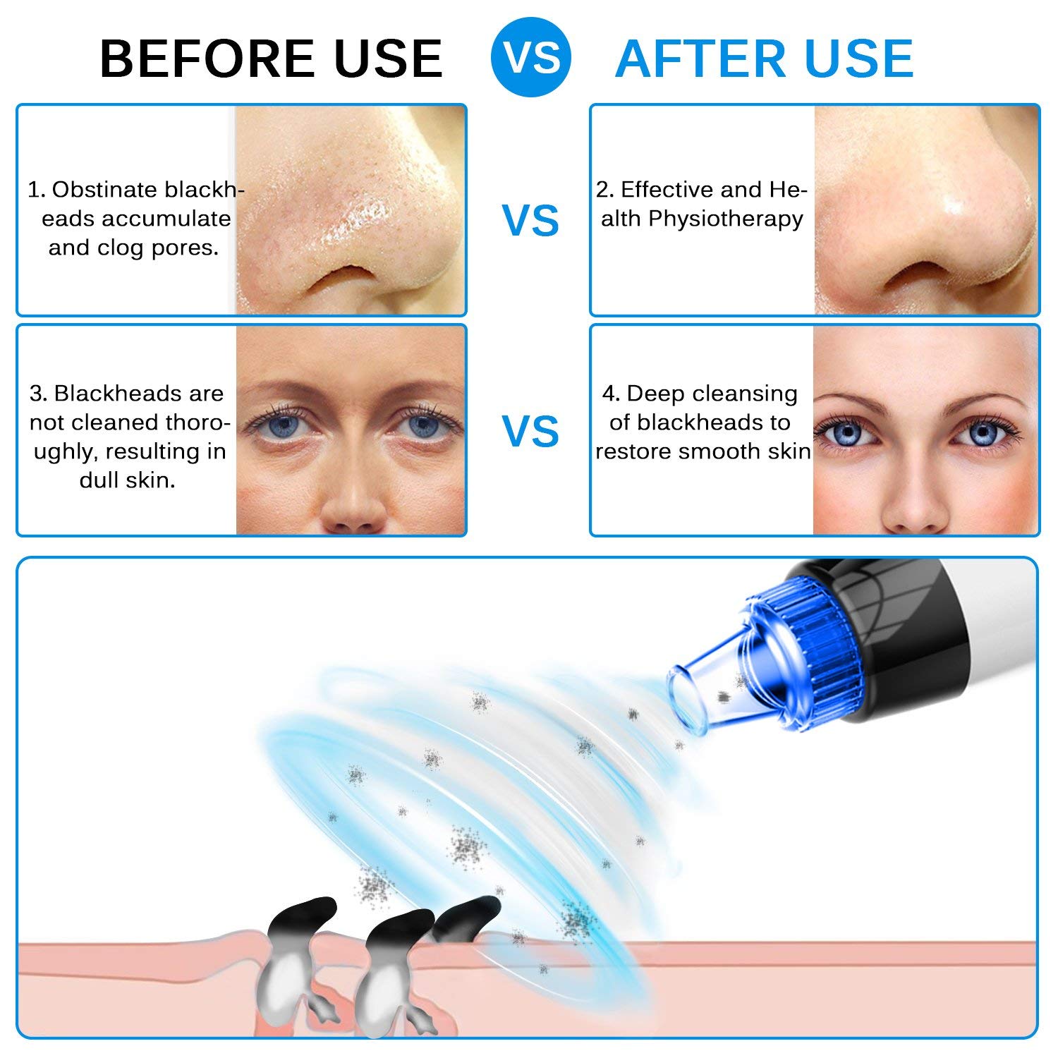Blackhead Remover, Pore Vacuum Electric Blackhead Vacuum Extractor Clean Tool - Comedo Pore Beauty Device with 6 Probes for Blackhead Remover Vacuum Suction Cleanser Microdermabrasion Pimple Extractor: Beauty