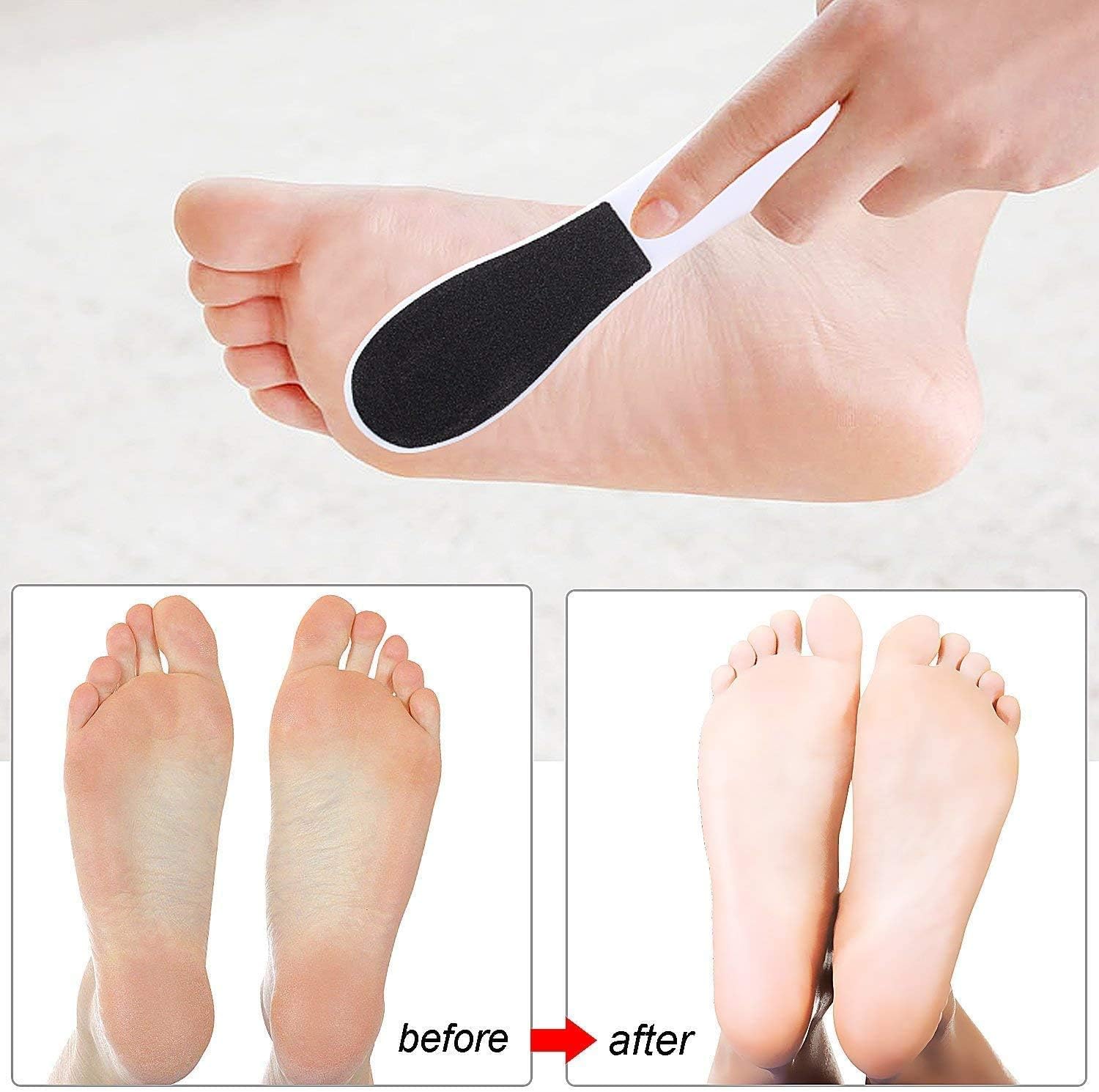 Rainmae Foot Files for Hard Skin,8 Packs Double-Sided Foot Rasp File and Callus Hard Skin Remover for Wet and Dry Cracked Feet(White) - Image 5