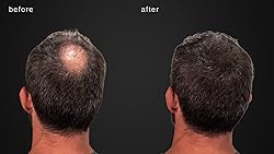 MAXX PRO-SERIES Volumizing Hair Fibers with real