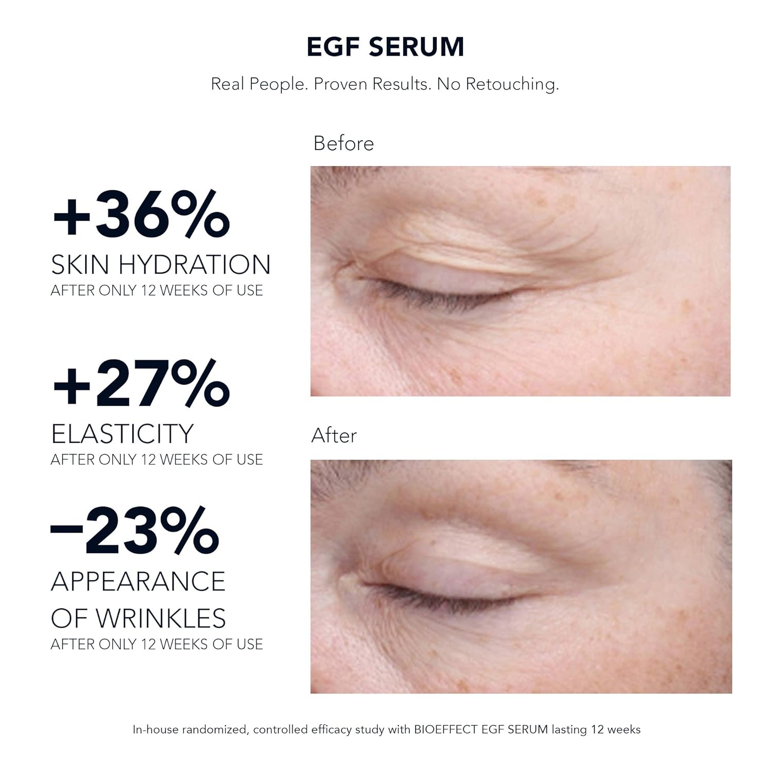 bioeffect serum before and after