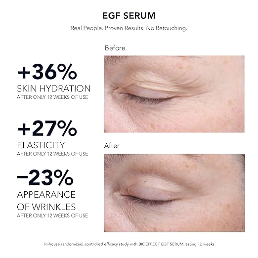 bioeffect egf serum amazon