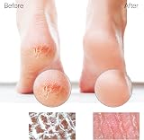 Sunivaca Glass Foot File - Callus Remover for Smooth Heels - 80% Larger view 4