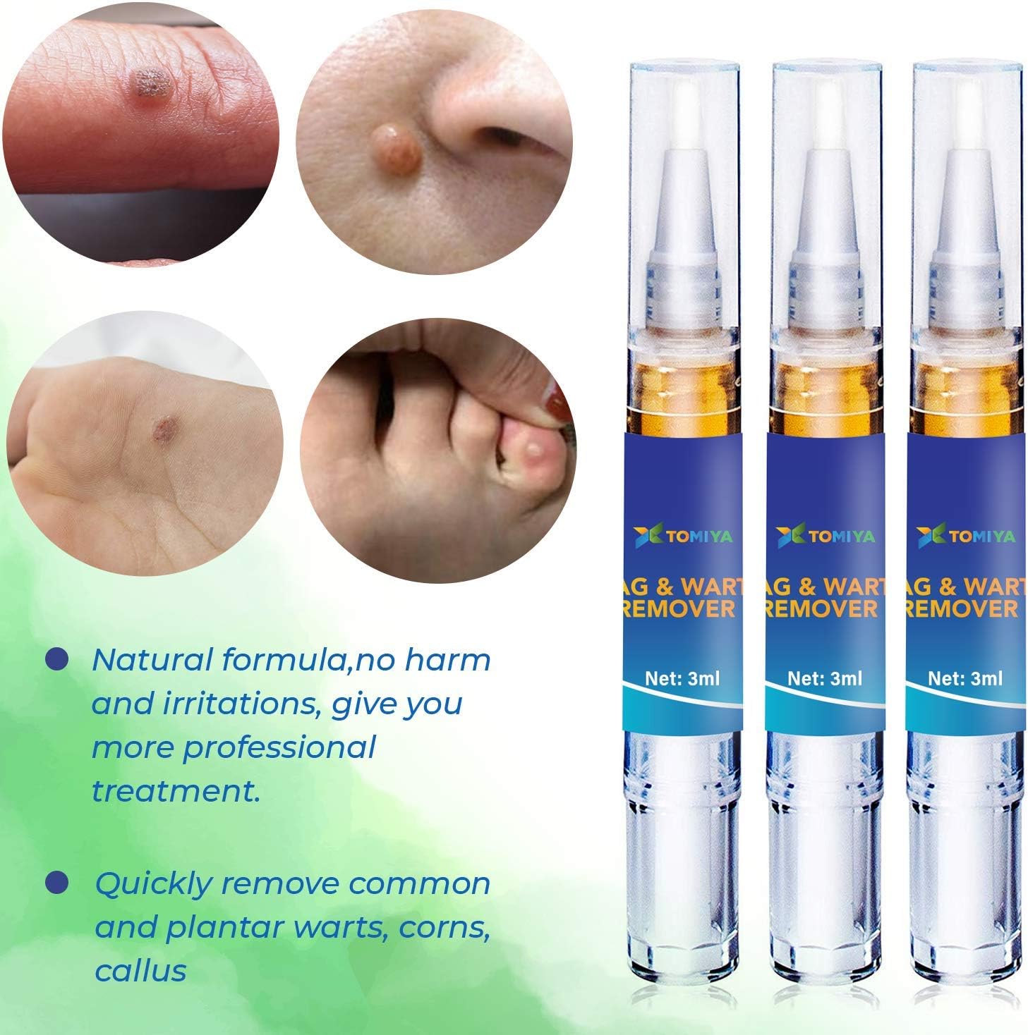 Tomiya Skin Tag Remover - Wart Remover - Quickly Remove Common And Plantar Warts - Corns - Callus -Skin Tag Removal(4 Packs) (Blue): Health & Personal Care