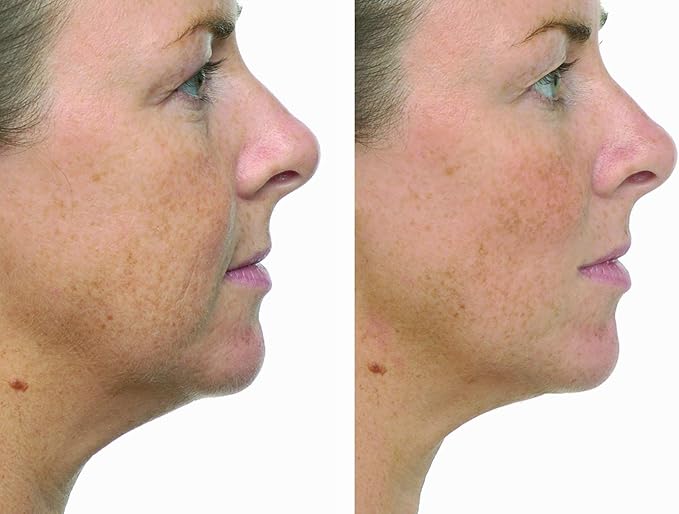 transformulas face contour & tightening cream