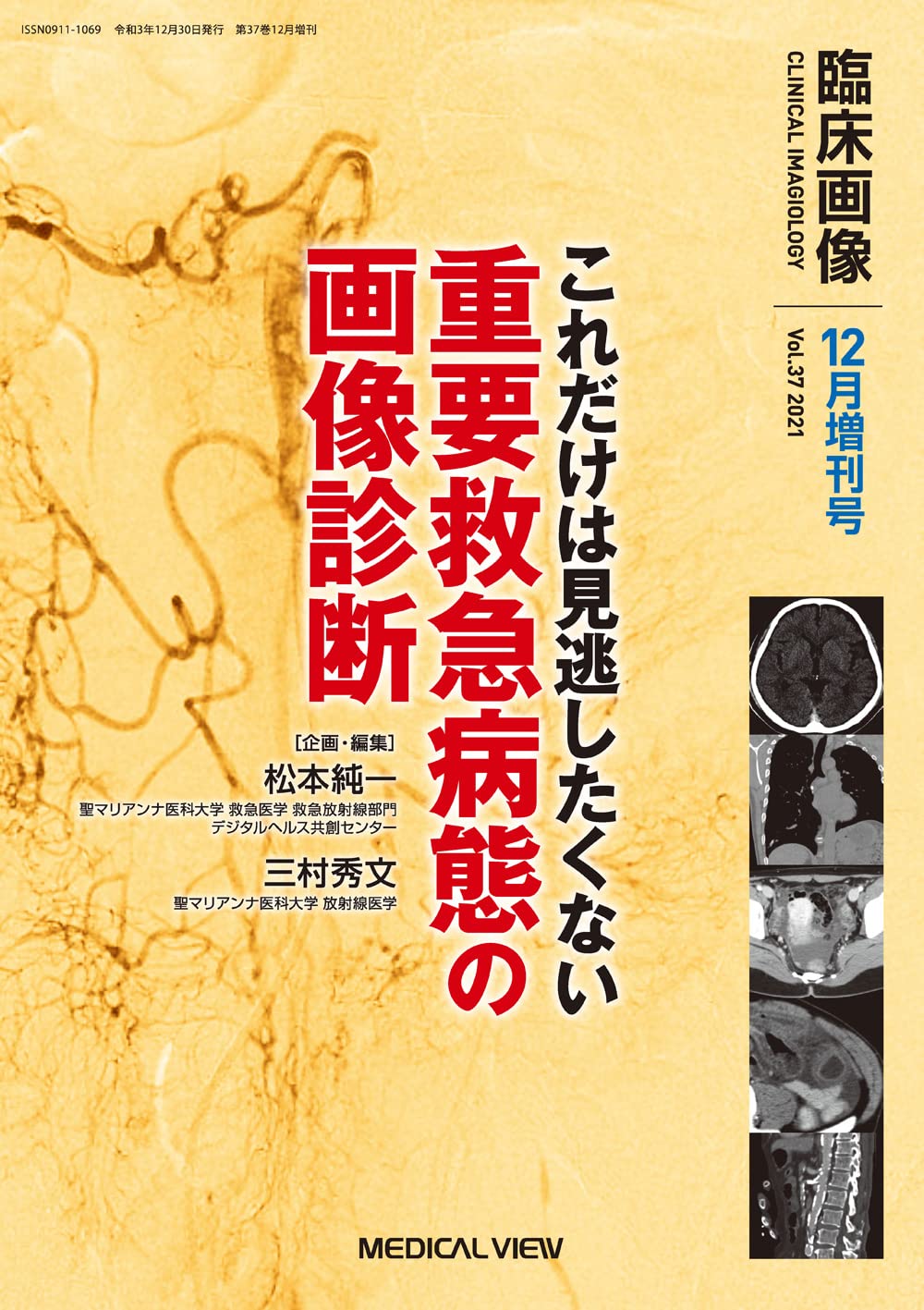 ポイント14倍 臨床画像 12月増刊号 これだけは見逃したくない重要救急病態の画像診断 送料無料5個セット 本 音楽 ゲーム 本 Roe Solca Ec