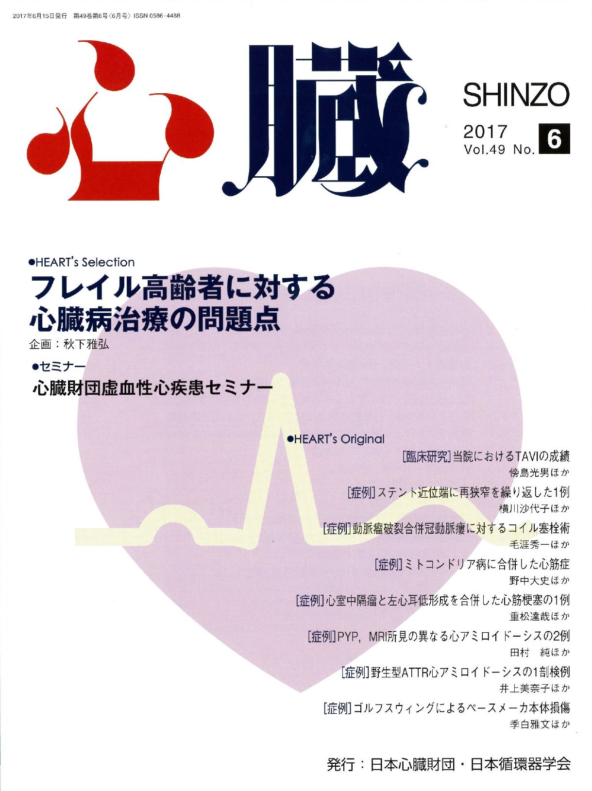 心臓 17年 06 月号 雑誌 紙谷 寛之 秋下 雅弘 江頭 正人 大石 充 小原 克彦 下浜 孝郎 傍島 光男 横川 沙代子 毛涯 秀一 野中 大史 重松 達哉 田村 純 井上 美奈子