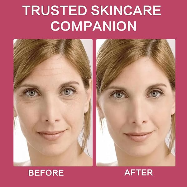 ABOTE ROSE FACIAL SERUM WITH 2.3% HYALURONIC ACID SERUM FOR FACE PLUMP SKIN MOISTURIZING MOISTURIZE SMOOTHES WRINKLES (3 PACK 1FL.OZ|30ML EACH)