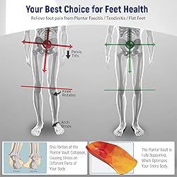 Plantar Fasciitis Relief Arch Support Shoe Inserts