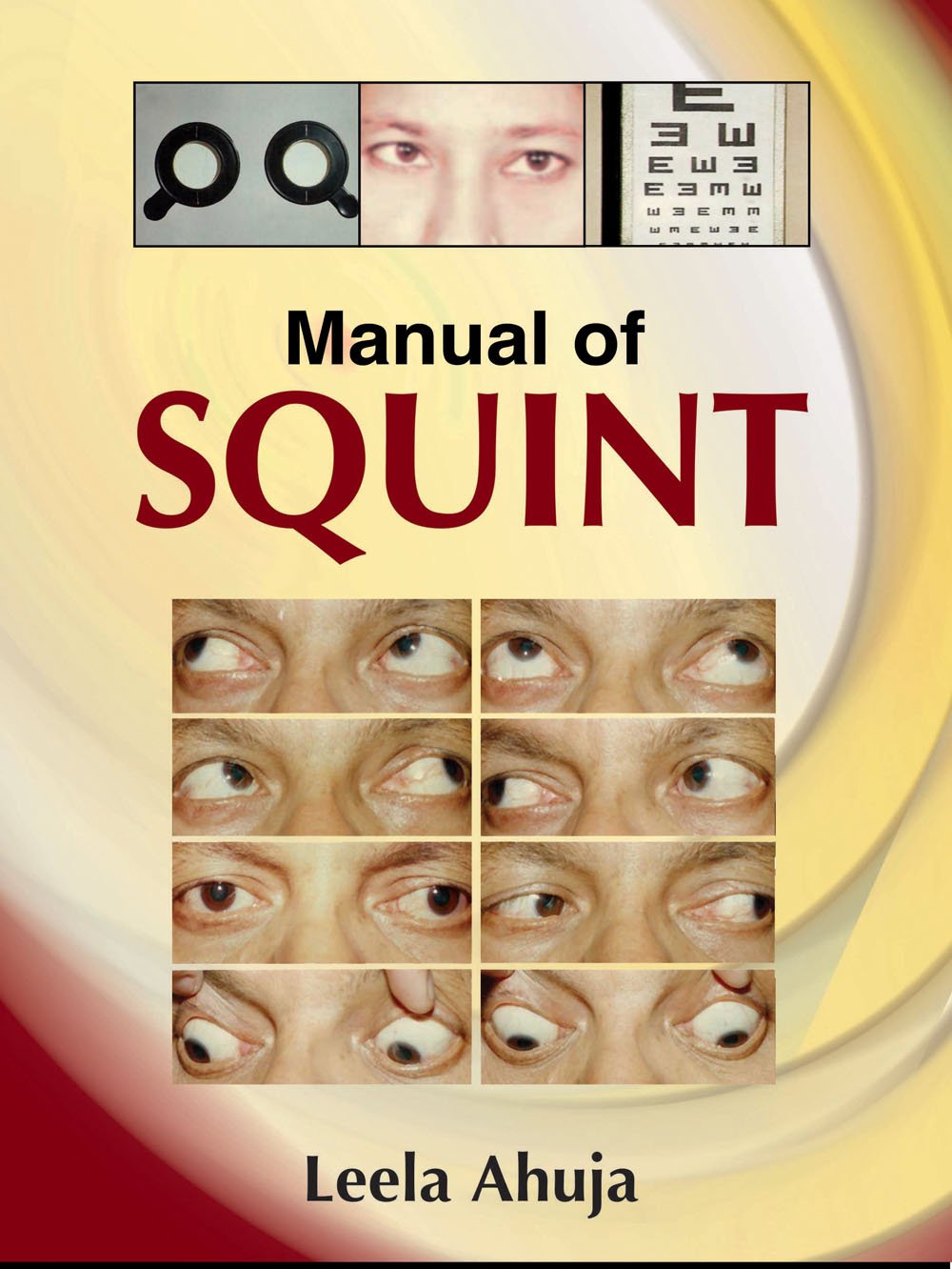 Buy Manual Of Squint Book Online at Low Prices in India | Manual Of Squint  Reviews & Ratings - Amazon.in