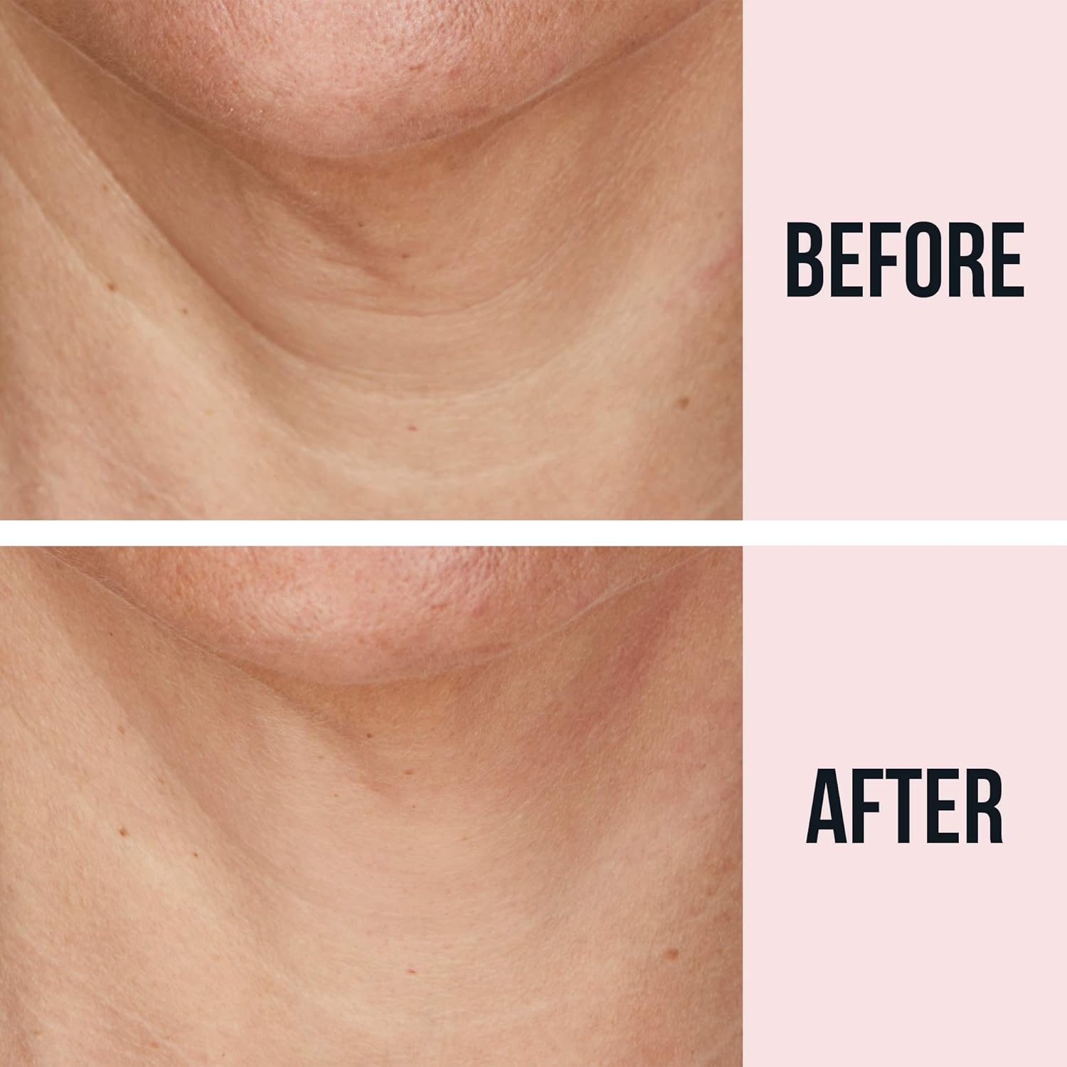 SiO Beauty NeckLift | Neckline Anti-Wrinkle Patch | Overnight Smoothing Silicone Patches For Neck Wrinkles, Fine Lines And Turkey Neck: Beauty