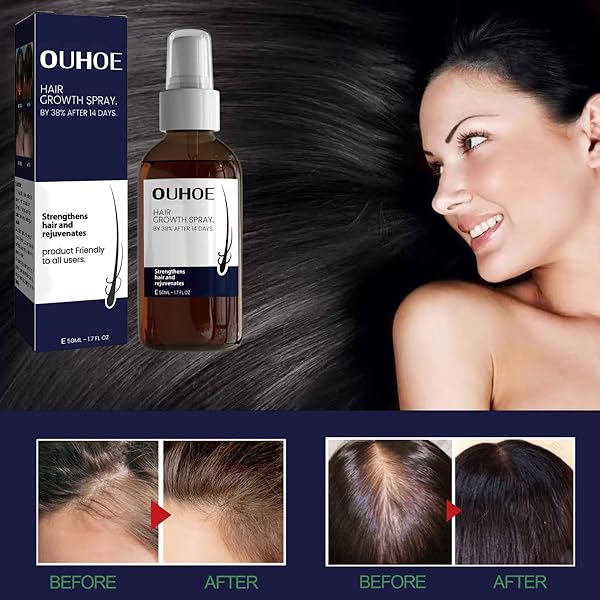 QUAAM 2PCS OUHOE HAIR GROWTH SPRAY, BROWN, UNISEX-ADULTS