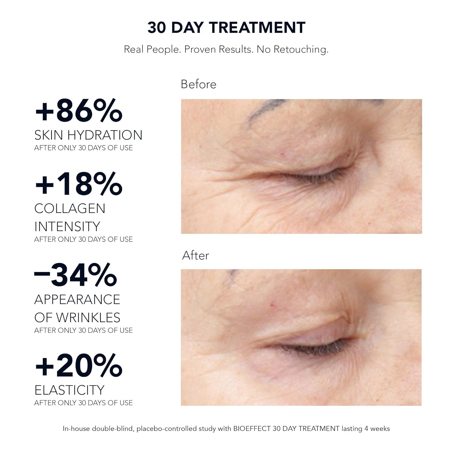 bioeffect before and after