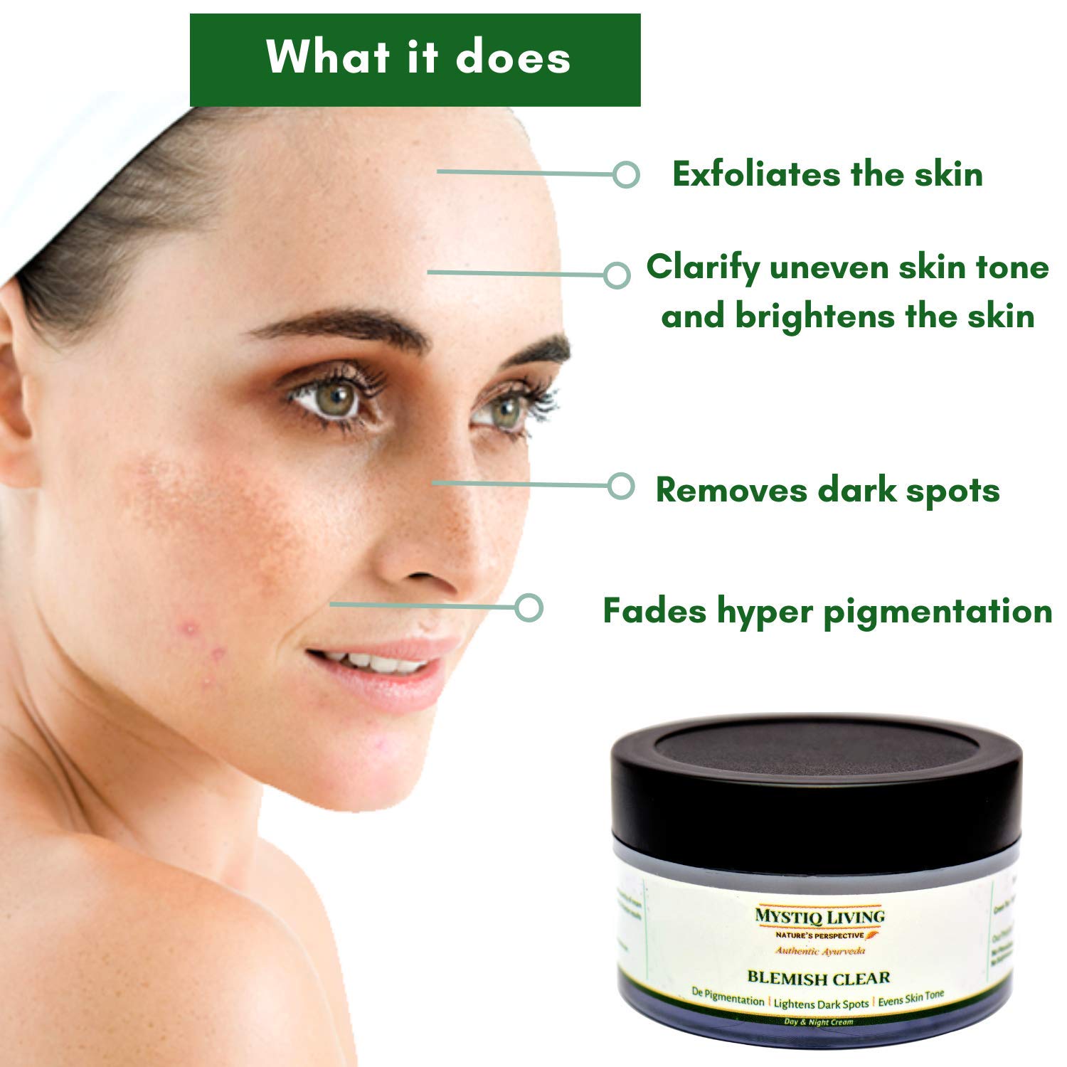 pigmentation dark spot cream