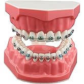 Dentalmall Typodonts Orthodontics Demonstration Model with Metal Wires and Bracket Teaching, Learning, Interpretation Model for Adults and Children (Metal Bracket)