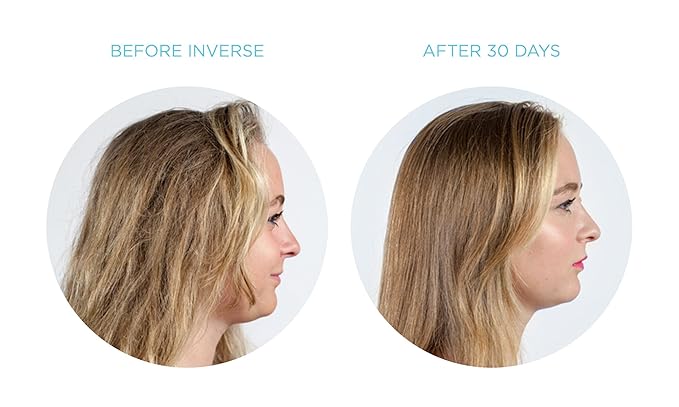 ice conditioning straightener