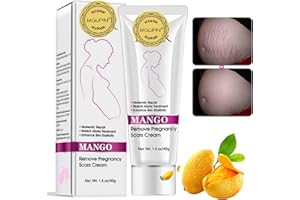 MQUPIN RtopR Mango Stretch Marks and Scar Cream -Stretch Marks and Scar Removal Cream for Pregnancy - Best Body Moisturizer-40g