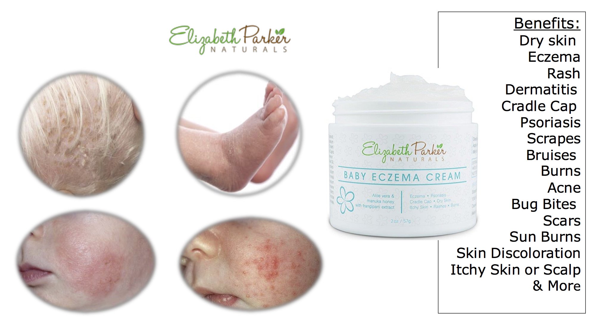 Baby Eczema Cream Face Body Sensitive Skin Instant Itch Relief Coconut